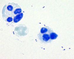 Methylene Blue stain