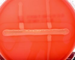 CAMP-test_Listeria monocytogenes & L. ivanovii