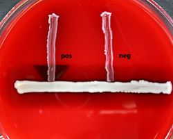 CAMP-test_Streptococcus agalactiae