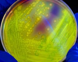 Fluorescence_Fusobacterium necrophorum, F. nucleatum and F. species