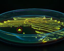 Fluorescence_Fusobacterium necrophorum, F. nucleatum and F. species