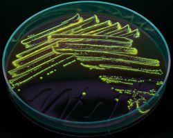 Fluorescence_Fusobacterium necrophorum, F. nucleatum and F. species