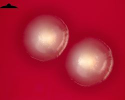 Fluorescence_Fusobacterium necrophorum, F. nucleatum and F. species