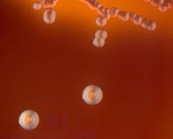 Fluorescence_Fusobacterium necrophorum, F. nucleatum and F. species