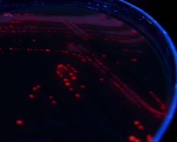 Fluorescence_Fusobacterium necrophorum, F. nucleatum and F. species