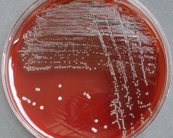 Fluorescence_Fusobacterium necrophorum, F. nucleatum and F. species