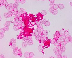 Granules_Aggregatibacter actinomycetemcomitans