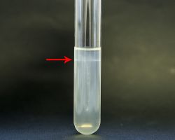 Motility_Listeria monocytogenes_semi solid media