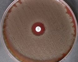 Optochin test