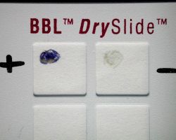 Oxidase test