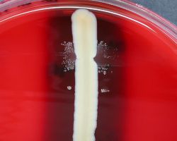 Satellitism test_Haemophilus influenzae