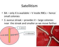 Satellitism test_Haemophilus influenzae